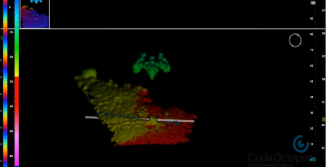 Content for Dredging page