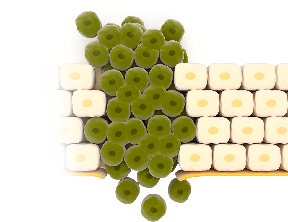 Pancreatic Proenzyme<br>Therapy