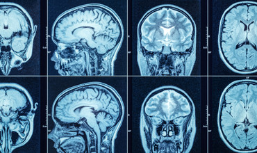 Final Validation and Selection 
