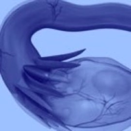 Ovarian