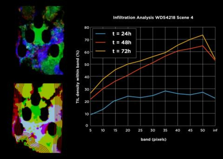 Graph and images showing tumor death over 72 hours using EVIDENT microdevice and Draper's algorithm.