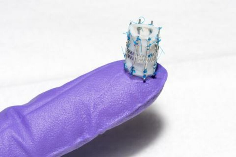 A pediatric heart valve, held by a gloved hand.