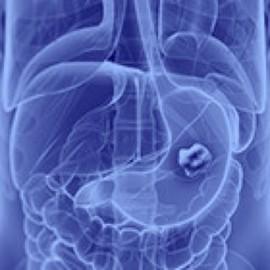 Gastric