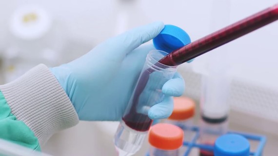 Our Research: A Rich Cell Therapy Pipeline for the Future