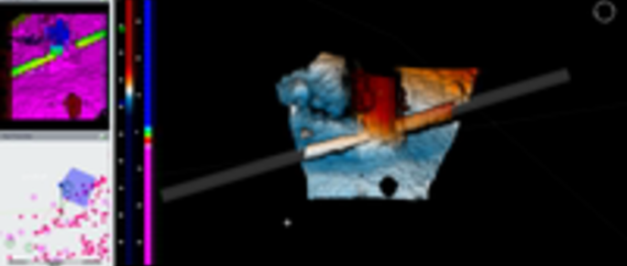 Trenching and Rock Dumping