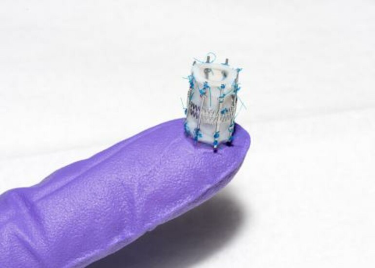 Close-up of a pediatric heart valve, held by a gloved hand.