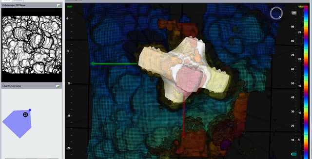 Content for Breakwater Construction and Management page