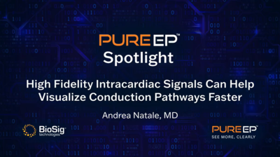 High Fidelity Intracardiac Signals Can Help Visualize Conduction Pathways Faster