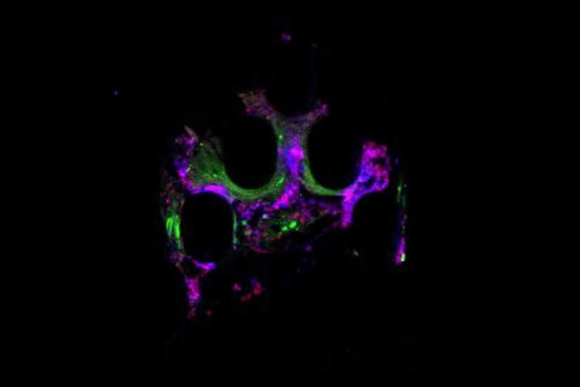Immune cells (green and red) surround a cancer cell (blue) in the center, preparing to destroy it.