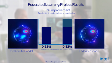 Penn Medicine and 71 international healthcare and research institutions used Intel’s federated learning hardware and software to demonstrate improved detection of rare cancer boundaries by 33% compared to an initial AI model trained using public data. (Credit: Intel Corporation)
