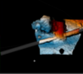 Trenching and Rock Dumping