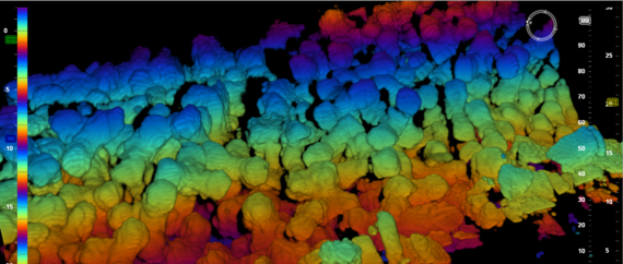 Breakwater Construction and Management