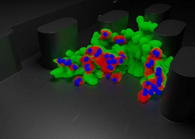 Modified immune cells (green and red) attacking a tumor (blue) in a lab setting.