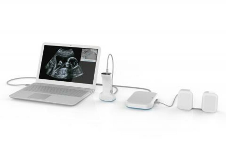 Prototype of Draper's ultrasound technology for early detection of high-risk pregnancies.