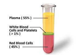 Plasma