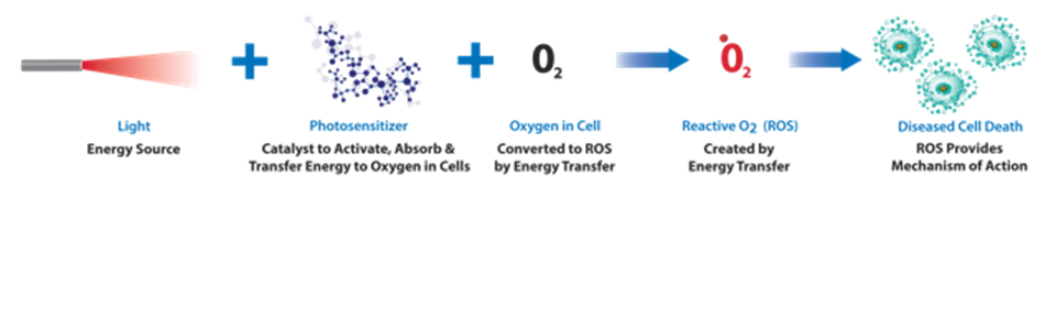 An infographic showing the photodynamic therapy process and the ROS mechanism of action against tumors.